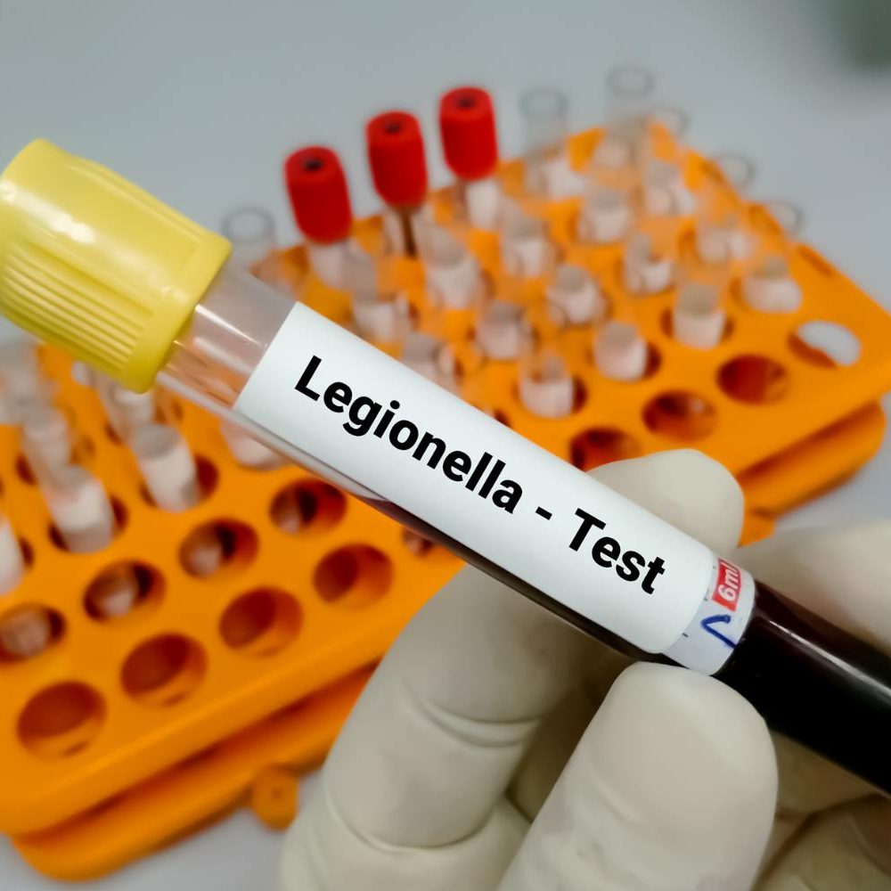 Obtaining Legionella Testing Certificates in London